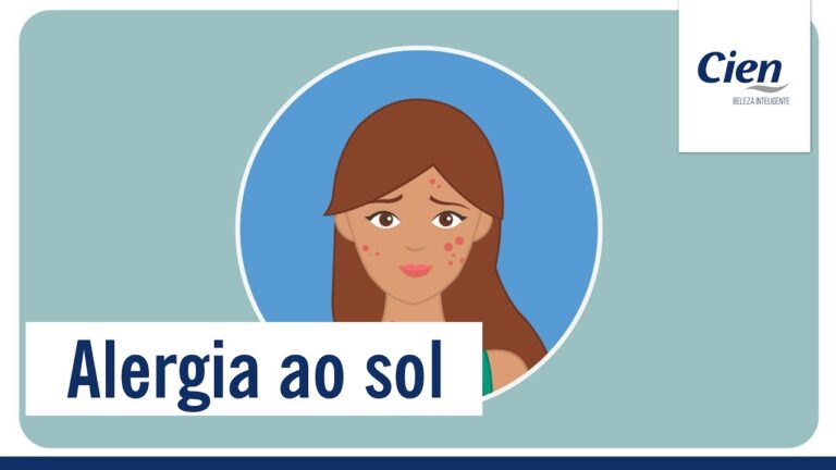 Alergias Solares: Causas, Sintomas e Tratamentos