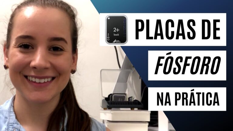 A Import&acirc;ncia da Placa Radiogr&aacute;fica na Diagn&oacute;sticos Modernos