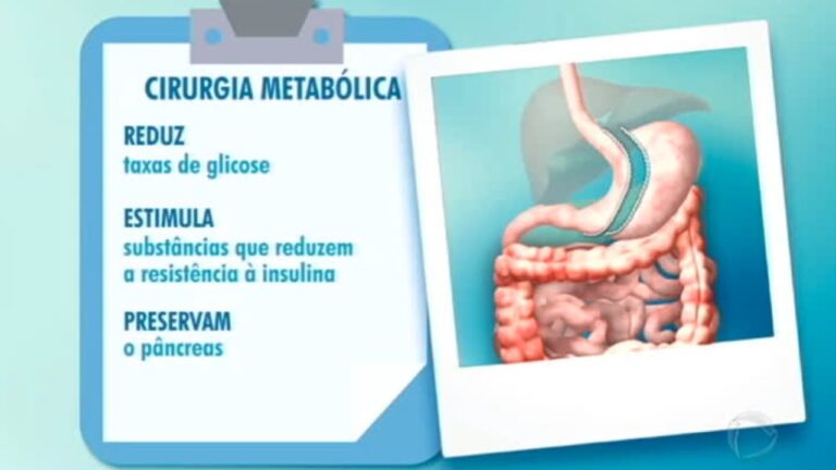 Pre&ccedil;o da cirurgia metab&oacute;lica: o que saber antes de decidir