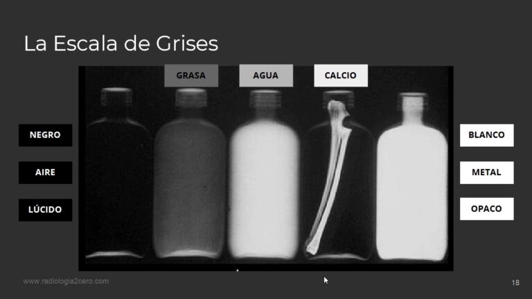5 Densidades Básicas em Radiologia