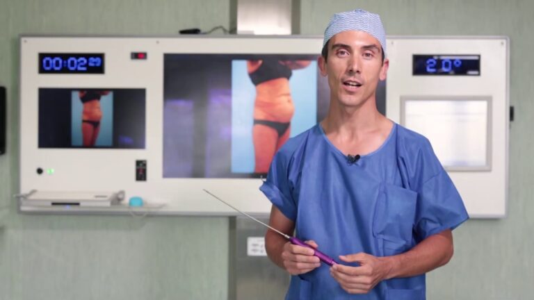 Lipoaspira&ccedil;&atilde;o em Portugal: Pre&ccedil;os e Considera&ccedil;&otilde;es Essenciais