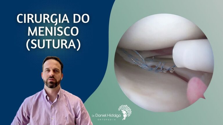 Operação Menisco: Recuperação e Resultados Eficazes